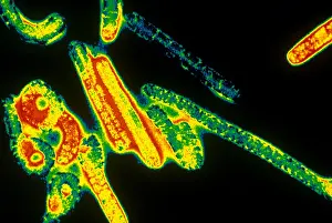 Virus Prints: Marburg Virus (TEM)