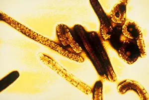 Virus Prints: Marburg Virus (TEM)