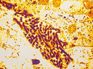 Virus Prints: Marburg Virus (TEM)