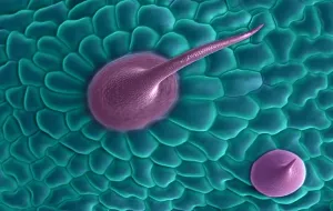 False Prints: Marijuana, Cannabis sativa, scanning electron micrograph