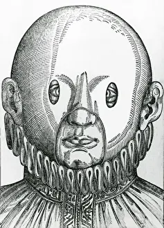 Ophthalmology Prints: Mask for Correcting Crossed Eyes, 1583