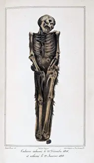 Court Prints: Mathieu Orfila, Decomposition On Exhumed Bodies, 1831