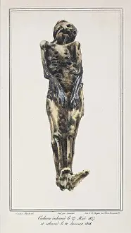 Court Prints: Mathieu Orfila, Decomposition On Exhumed Bodies, 1831