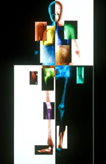 Concept Prints: Medical Imaging Montage