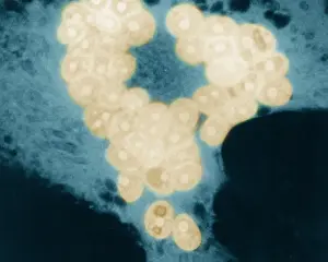 Negative Sense Prints: MeV, Measles Virus, TEM