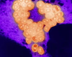 Negative Sense Prints: MeV, Measles Virus, TEM