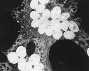 Negative Sense Prints: MeV, Measles Virus, TEM
