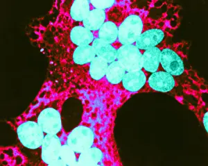 Microorganisms Prints: MeV, Measles Virus, TEM