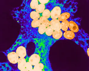 Microorganisms Prints: MeV, Measles Virus, TEM
