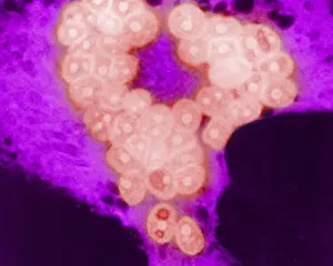 Pathogen Prints: MeV, Measles Virus, TEM