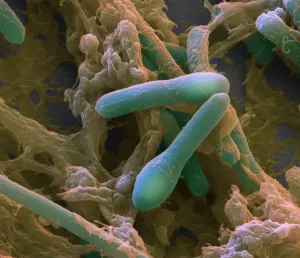 Gram Prints: Microscopic Photo of Clostridium Botulinum, Botulism Bacteria, Sem