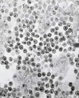 System Prints: Microscopic Photograph of the HIV Virus, the Cause of AIDS