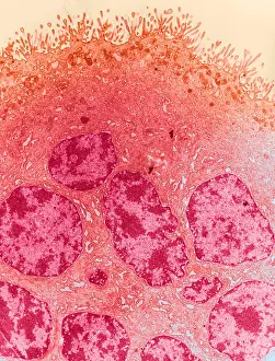 System Prints: Microscopic Photos of a Placenta, TEM