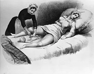 Cord Prints: Midwife Cutting Umbilical Cord, 1850