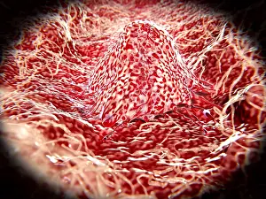 Blood Prints: Migrating cancer cell