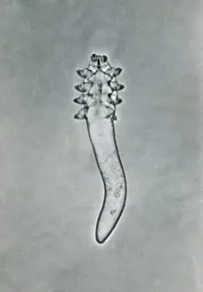 Mite Prints: Mite (Demodex folliculorum) under a microscope