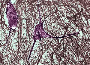 Cord Prints: Motor Neuron, TEM