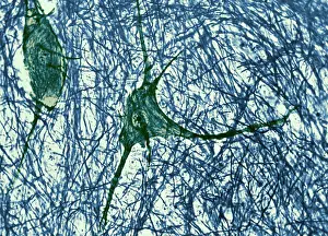 Fibers Prints: Motor Neuron, TEM