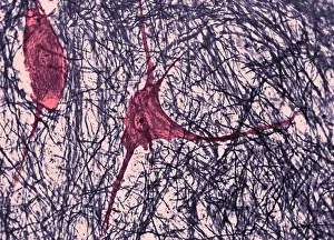Fibers Prints: Motor Neuron, TEM