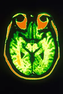 Magnetic Prints: MRI of Brain