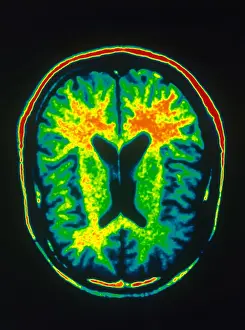 Magnetic Prints: MRI of Brain