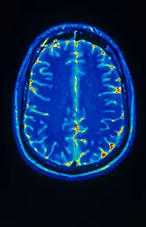Magnetic Prints: MRI of Brain