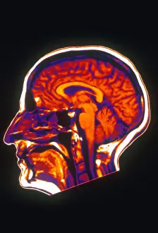 Magnetic Prints: MRI of Brain