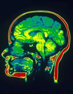 Magnetic Prints: MRI of Brain
