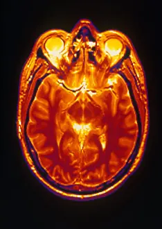 Magnetic Prints: MRI of Brain