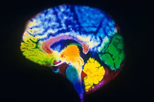 Magnetic Prints: MRI of Brain