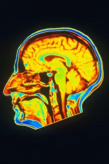 Magnetic Prints: MRI of Brain