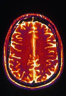 Magnetic Prints: MRI of Brain