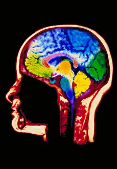 Scan Prints: MRI brain scan