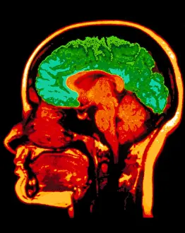 Horizontal Prints: MRI brain scan