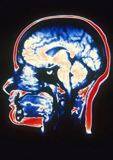 Magnetic Prints: MRI of Head