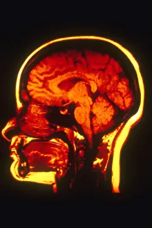 Magnetic Prints: MRI of Head