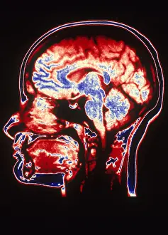 Magnetic Prints: MRI of Head