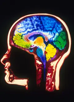 Magnetic Prints: MRI of Head
