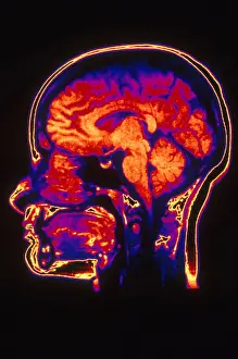 Magnetic Prints: MRI of Head