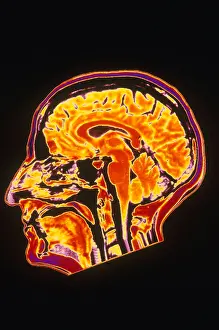 Magnetic Prints: MRI of Head