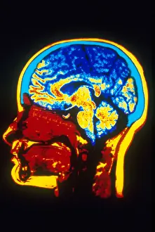 Magnetic Prints: MRI of Head