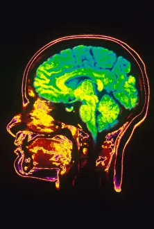 Magnetic Prints: MRI of Head