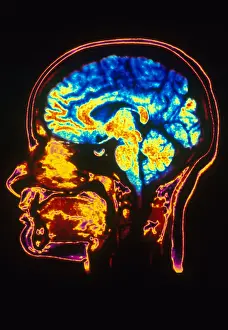 Magnetic Prints: MRI of Head