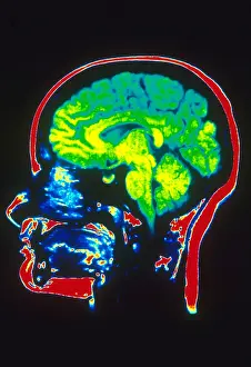 Magnetic Prints: MRI of Head