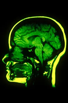 Magnetic Prints: MRI of Head