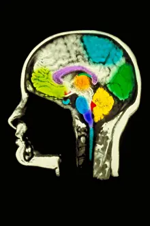 October Prints: MRI head scan