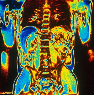 Magnetic Prints: MRI of Human Torso