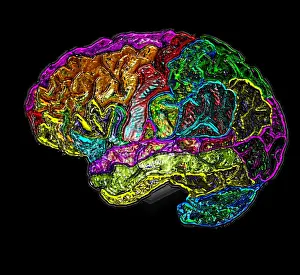Colour Prints: MRI of Normal Brain