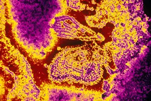 Histology Prints: Mumps Virus (TEM)