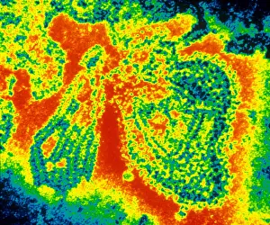 Tems Prints: Mumps Virus (TEM)
